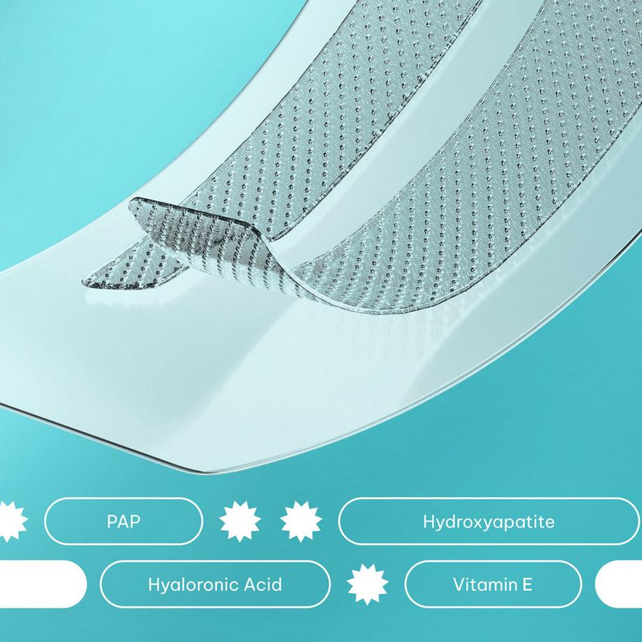 Smilepen Pop  Teeth Whitening Strips 'Iced Mint' 