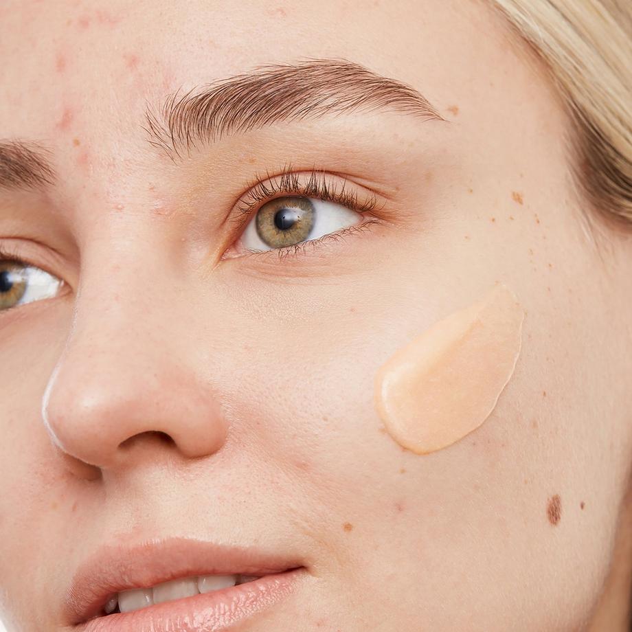 PEACE OUT SKINCARE  Gel detergente - Contro l'acne 