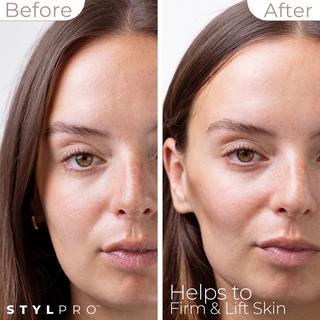 STYLPRO  Dispositivo per Tonificazione viso a Microcorrente 