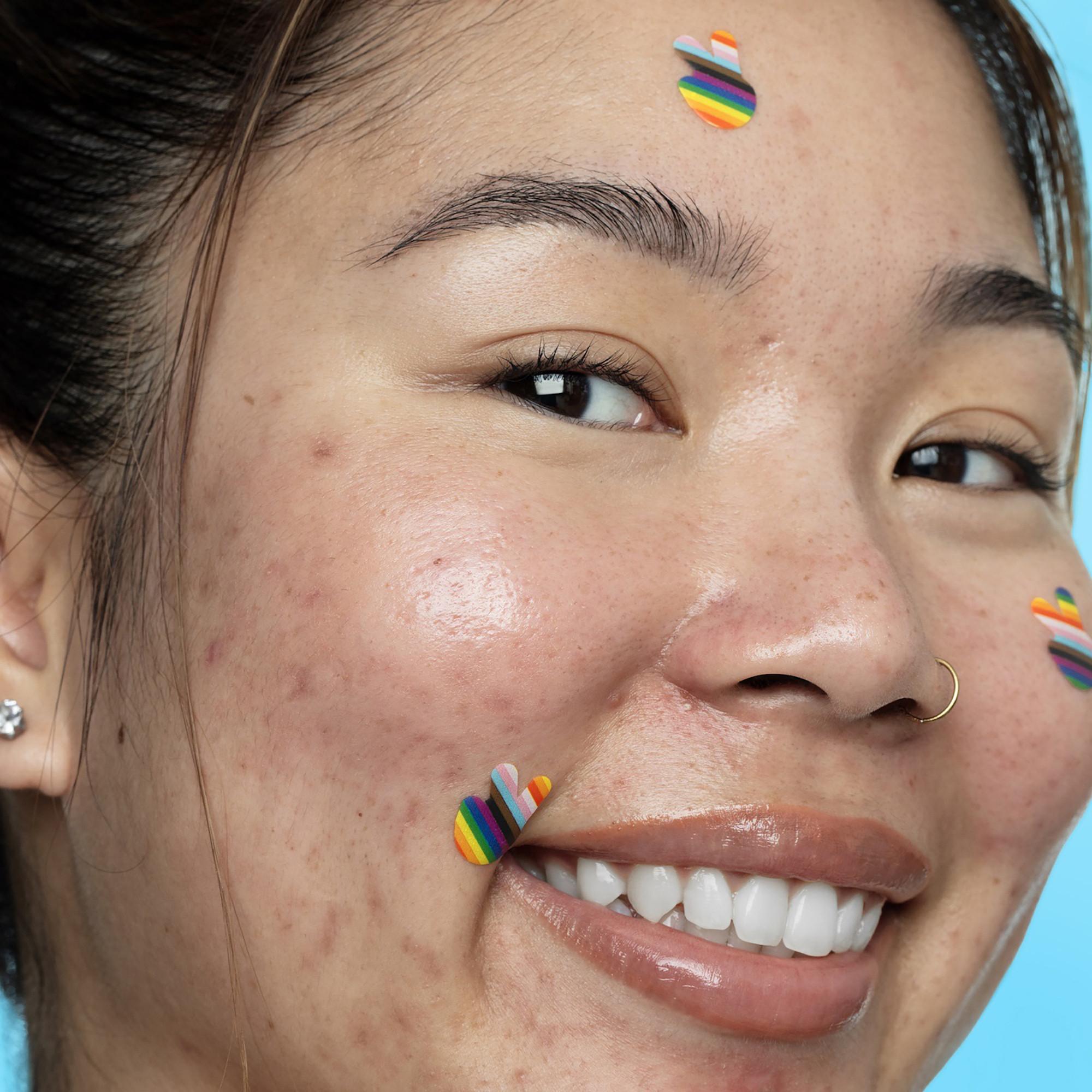 PEACE OUT SKINCARE  Pride Limited Edition-Patches für Aknebehandlung mit Salicylsäure 