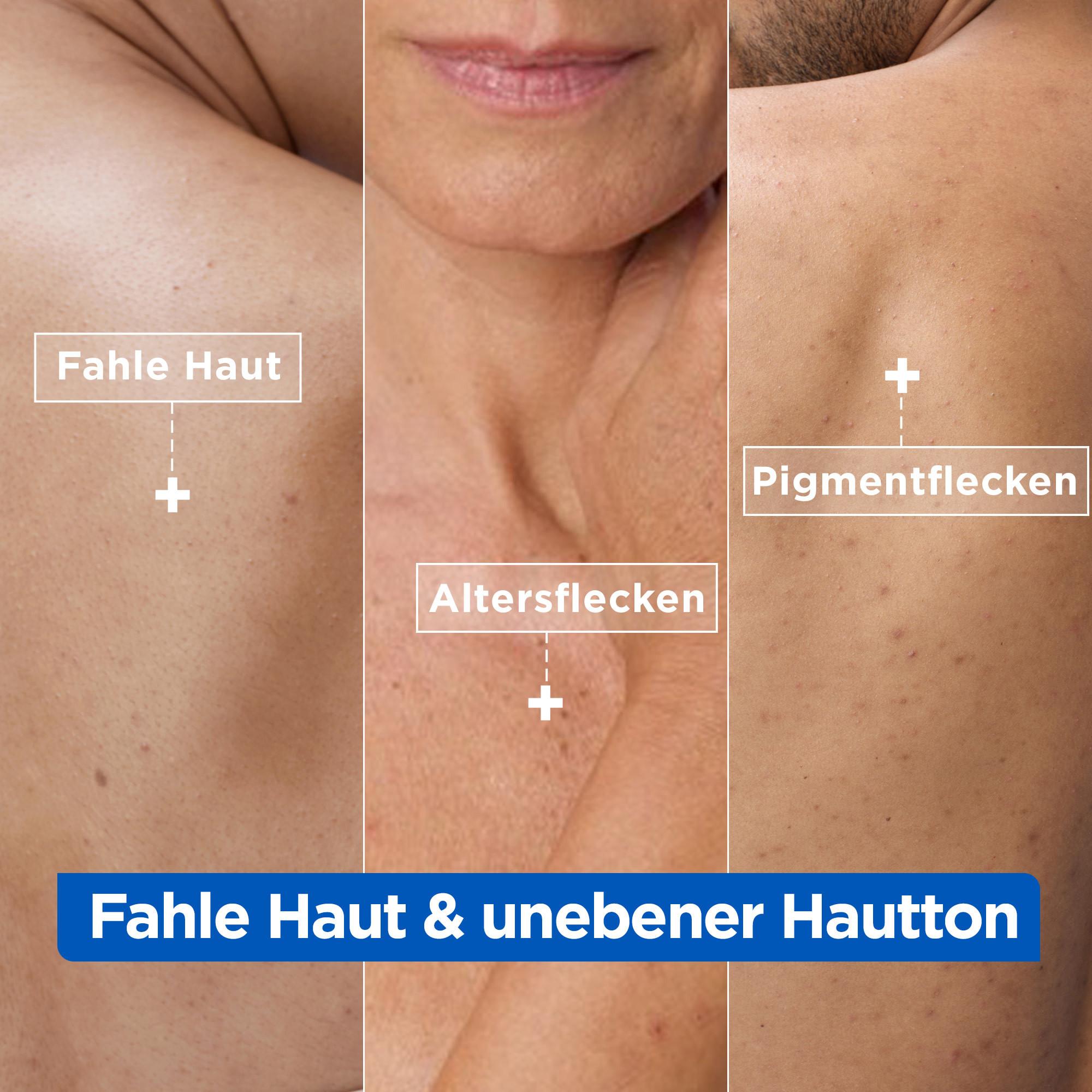 Mixa  Niacinamide Bright Pflegende Anti-Pigmentflecken Creme 