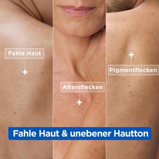 Mixa  Niacinamide Bright Pflegende Anti-Pigmentflecken Creme 