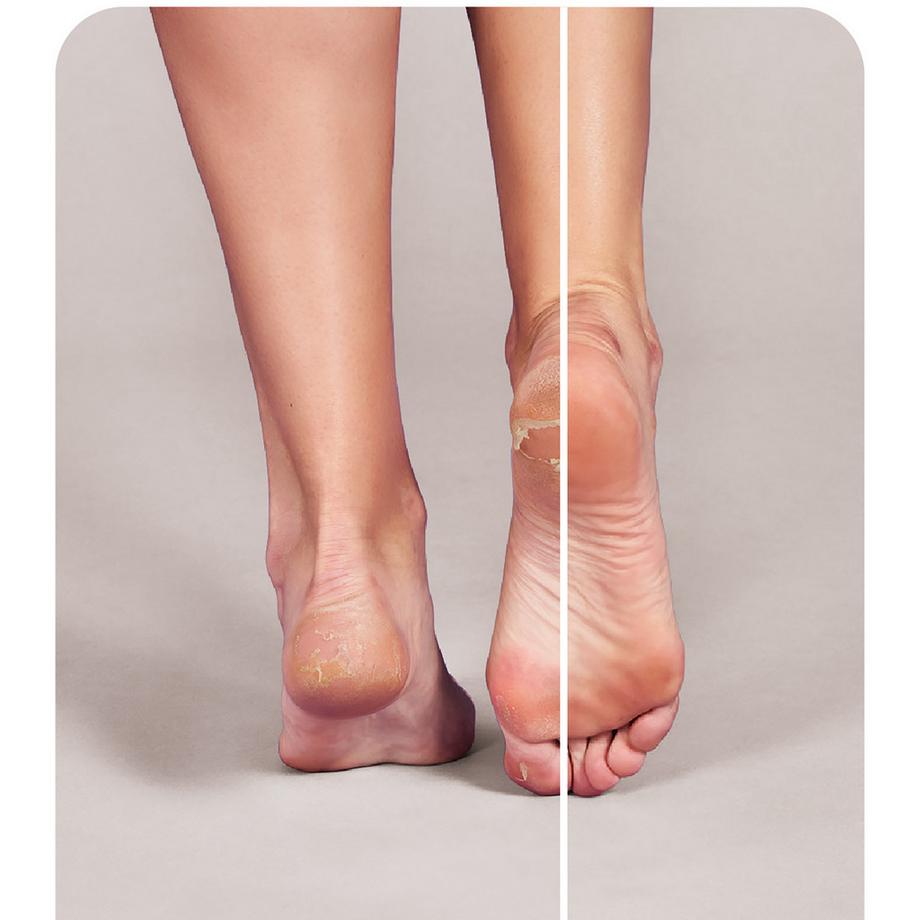 iroha  Socks Treatment For Feet | Exfoliating | Lavander (2 Units - One Use)  