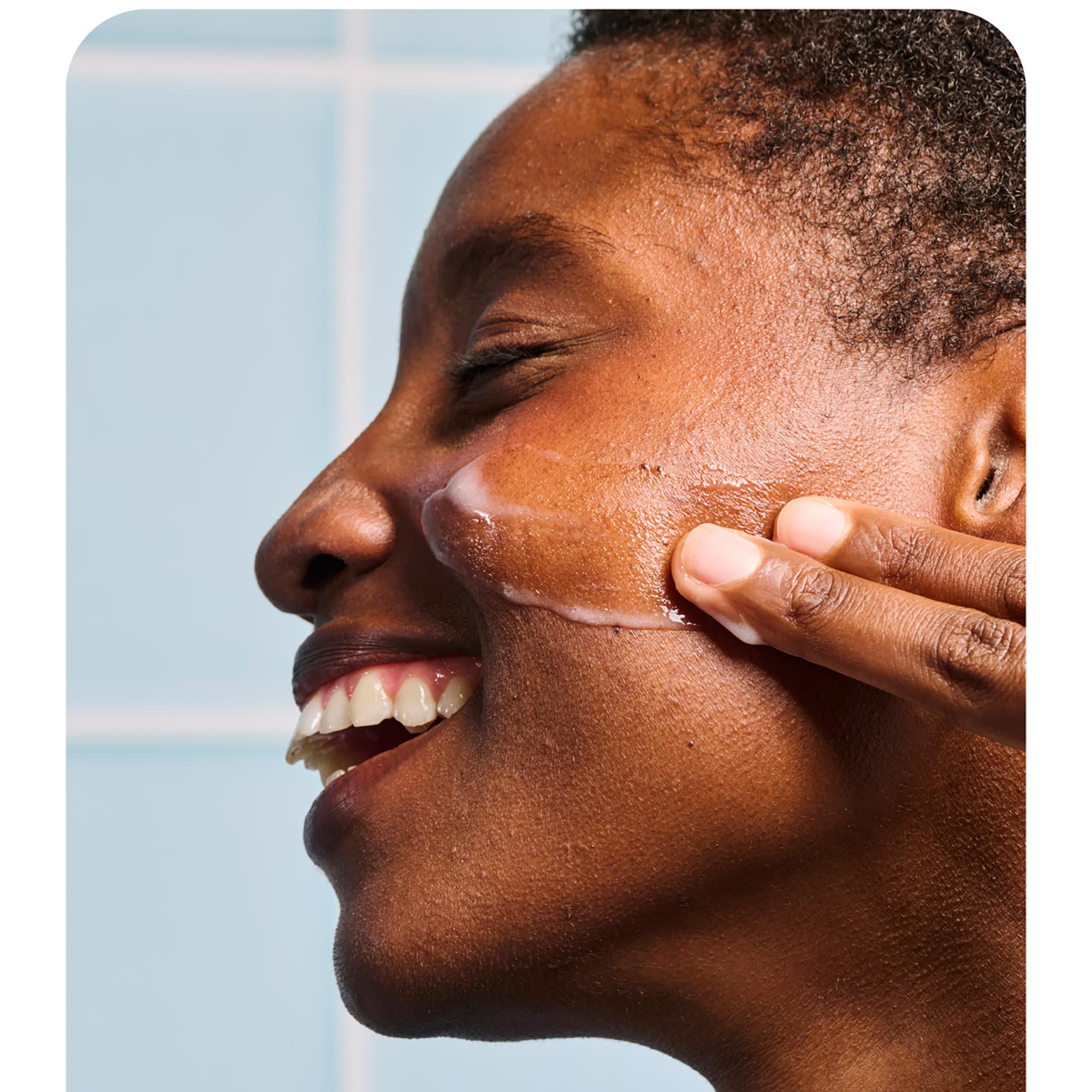 iroha  Acne Prone Face Cream Salycilic Acid 