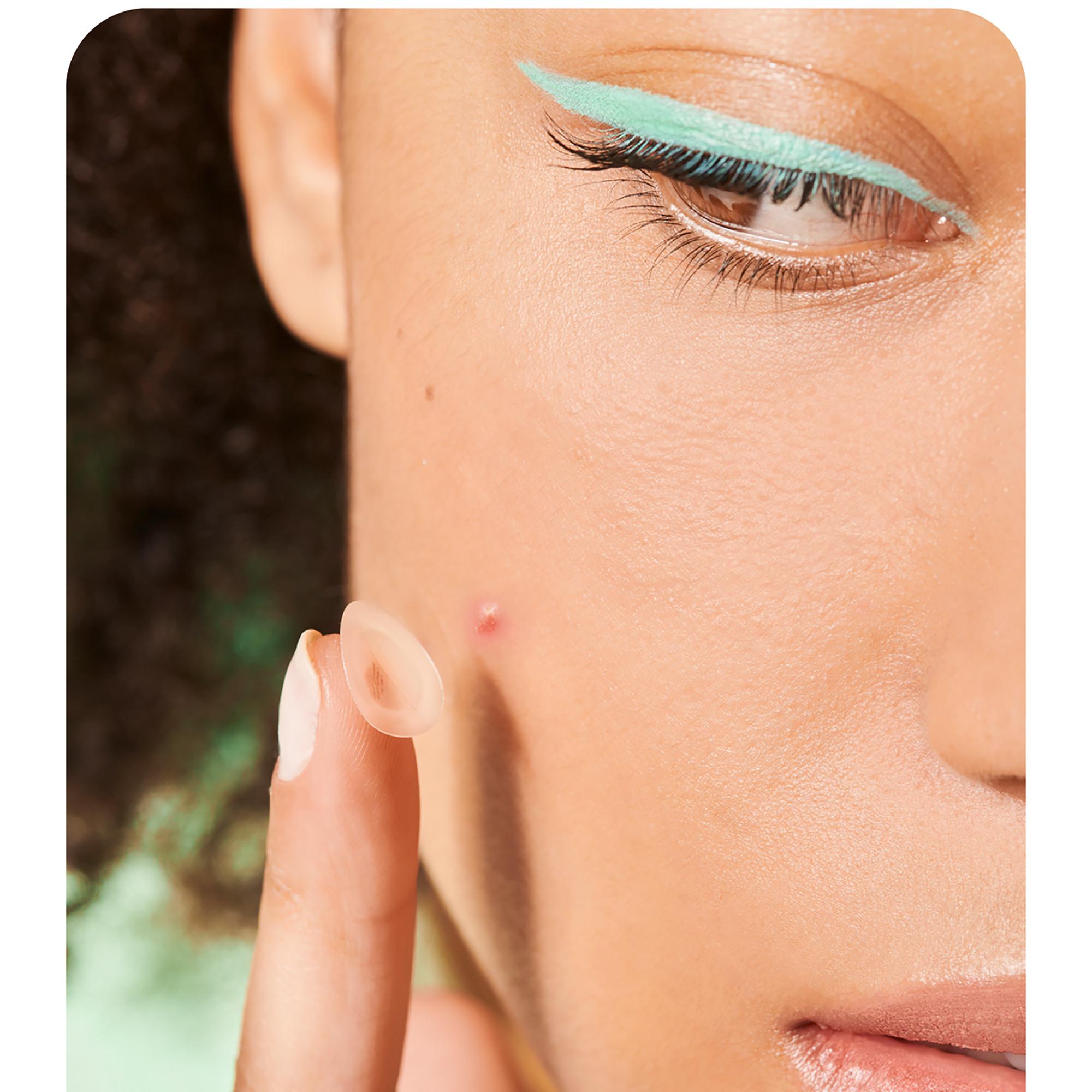 iroha  Nature Sos Pimple Patches With Salicylic Acid, Tea Tree And Centella Asiatica (Cica) 