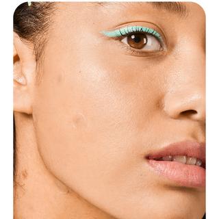 iroha  Nature Sos Pimple Patches With Salicylic Acid, Tea Tree And Centella Asiatica (Cica) 