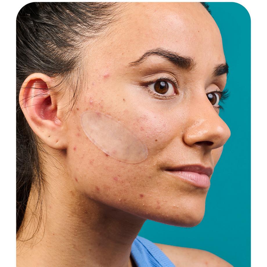 iroha  XL Pimple Patches 