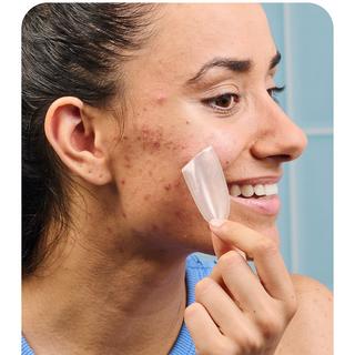 iroha  XL Pimple Patches 