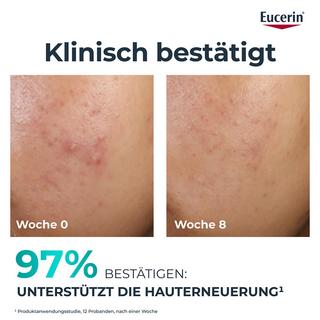 Eucerin  DERMOPURE CLINICAL Soin de Nuit Rénovateur  