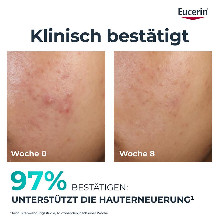 Eucerin  DERMOPURE CLINICAL  Peeling 10 - Hautbilderneuernde Nachtpflege 
