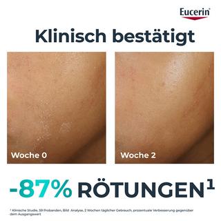 Eucerin  DERMOPURE CLINICAL  Hydra Repair - Therapiebegleitende Feuchtigkeitspflege 