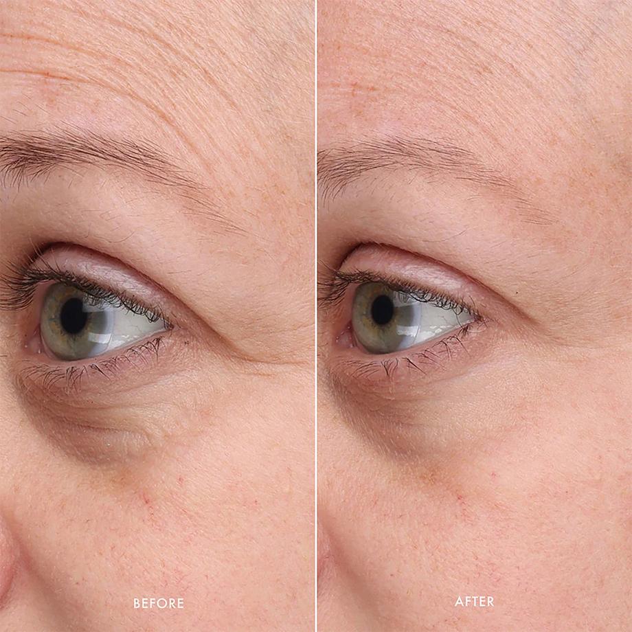 SUMMER FRIDAYS  Gentle Reset™ Daily Exfoliating Pads - Disques exfoliants quotidiens 