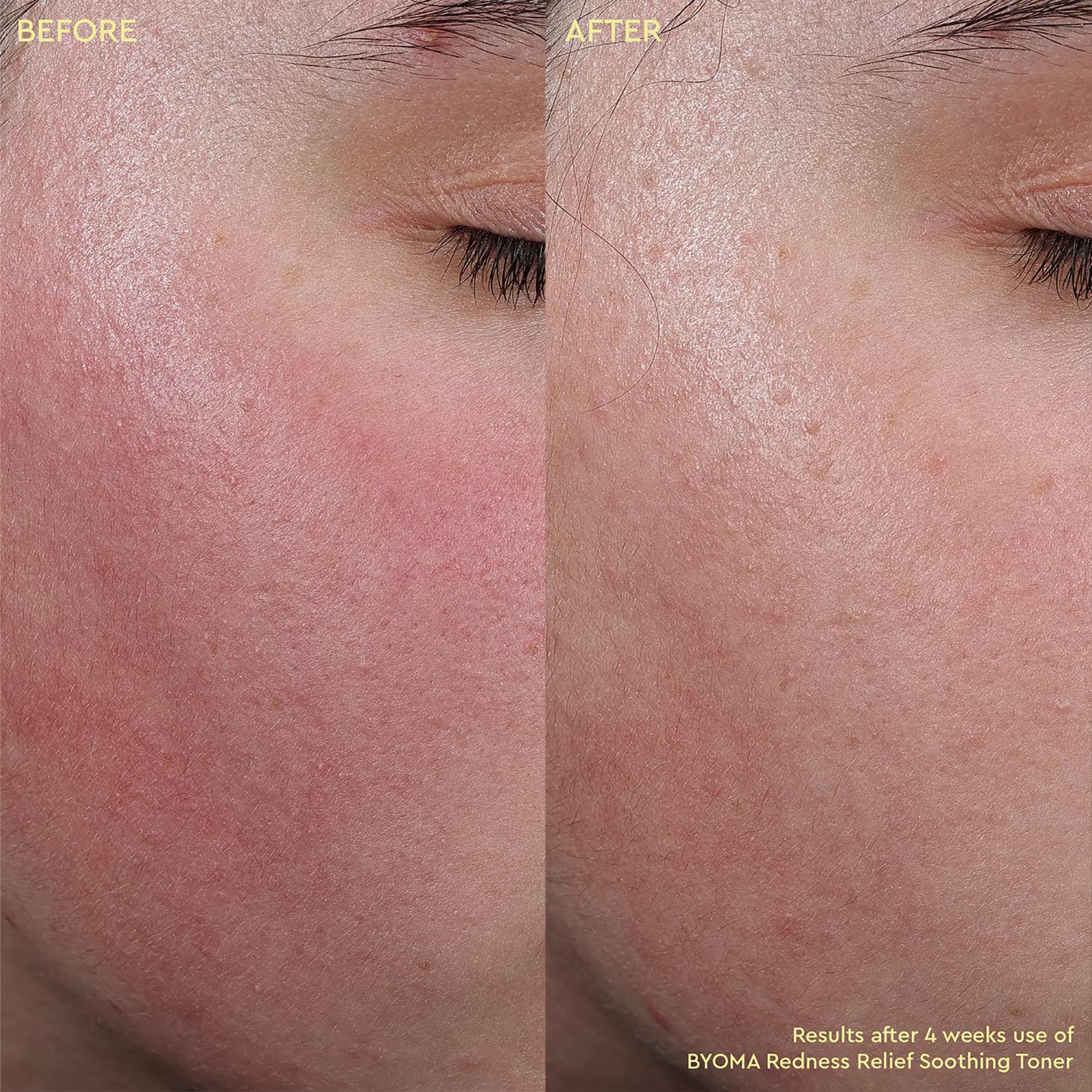 BYOMA  Rednes Relief Soothing Toner - Beruhigendes Gesichtswasser gegen Rötungen 