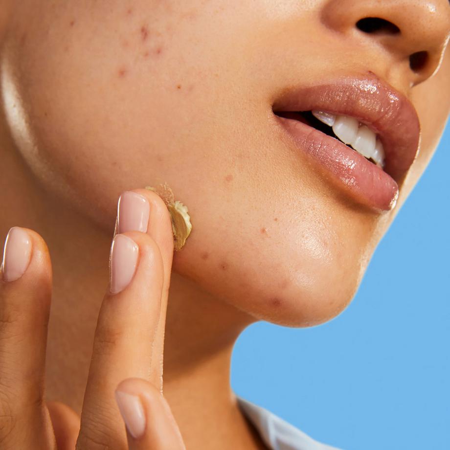 BYOMA  Blemish Clearing Paste- Pâte anti-imperfections 