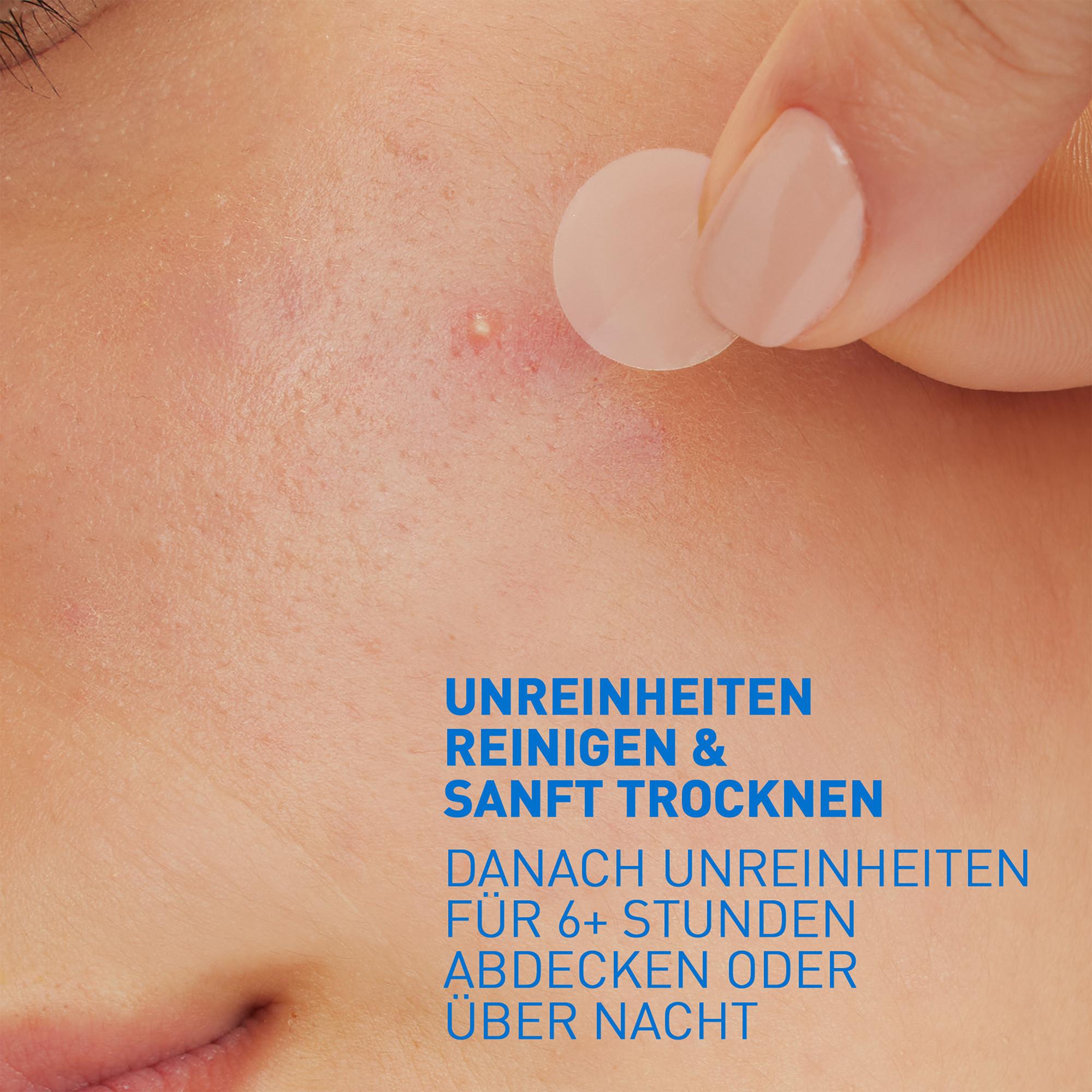 CeraVe  Anti-Unreinheiten Patches 