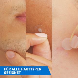 CeraVe  Anti-Unreinheiten Patches 