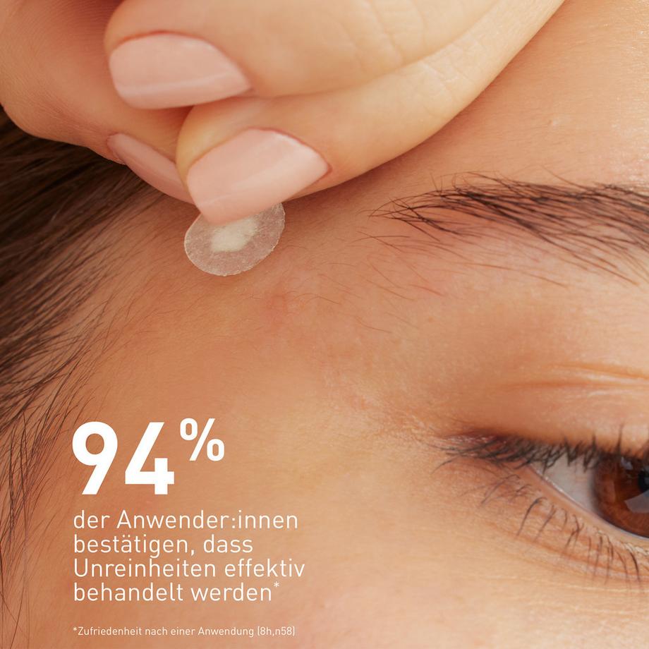 CeraVe  Anti-Unreinheiten Patches 
