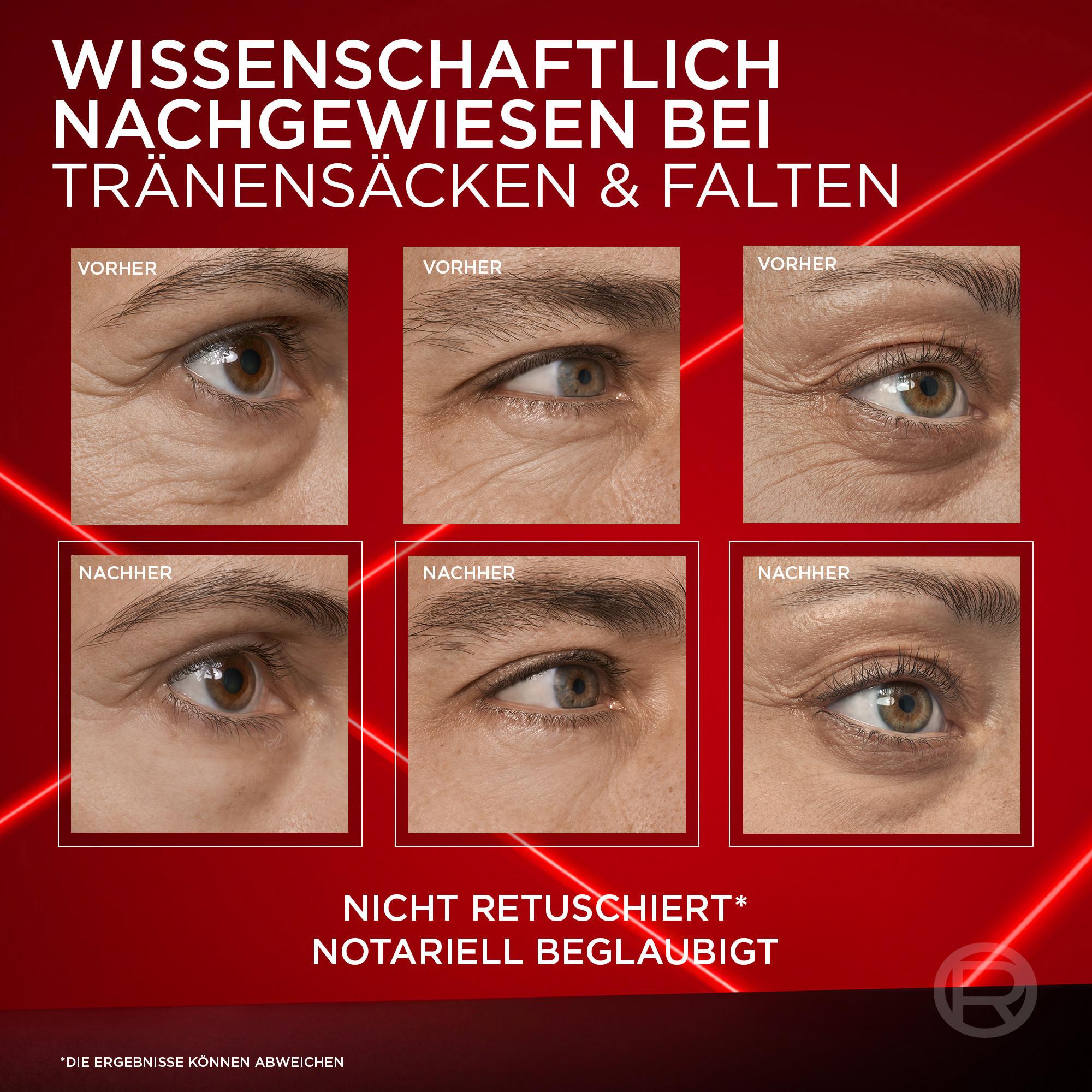 L'Oréal Paris  Revitalift Laser Anti-Tränensack Sofort Lifting 