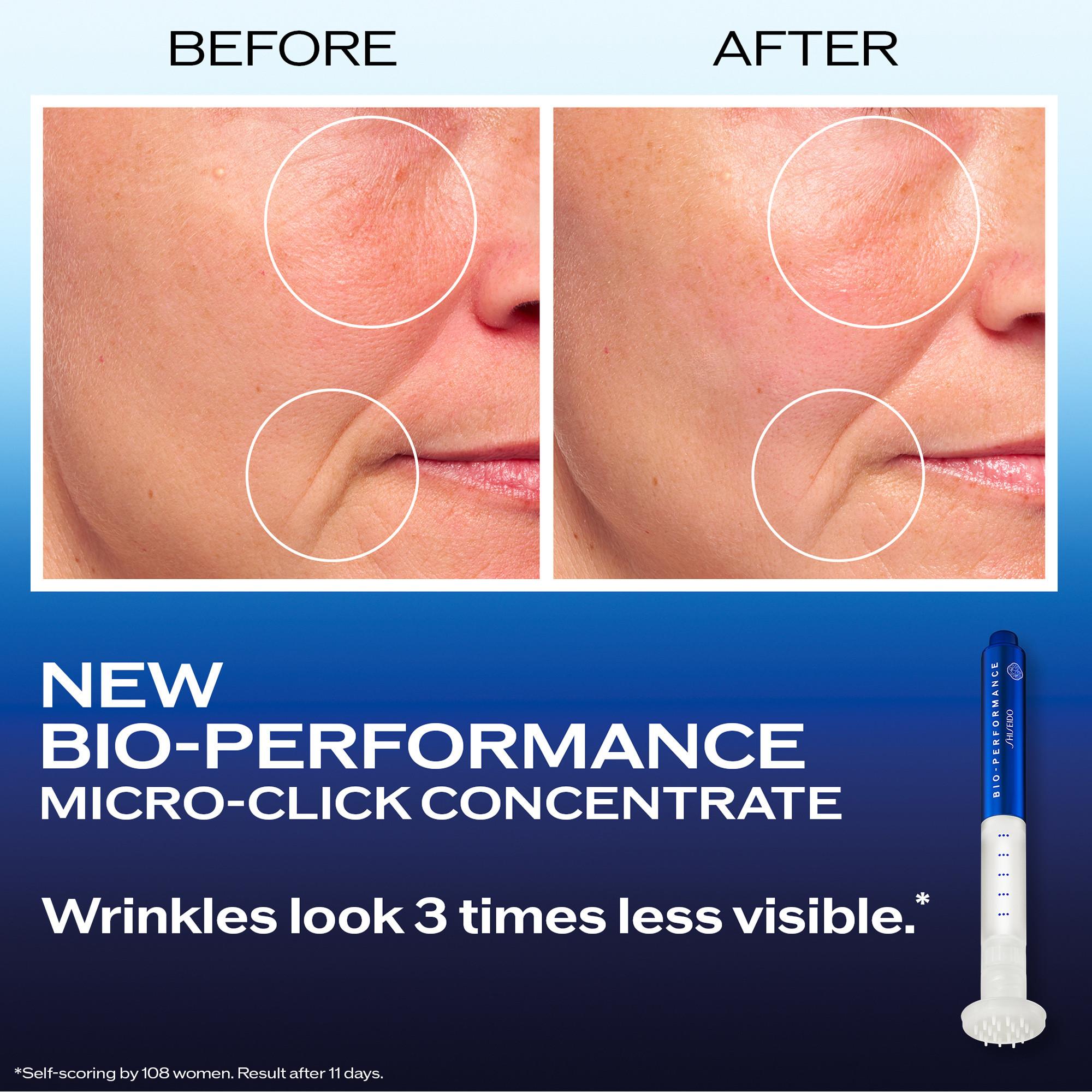 SHISEIDO  Micro-Click Concentrate 
