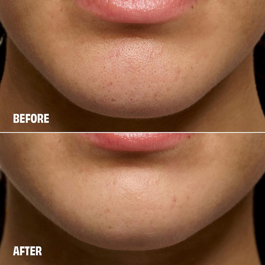 benefit  The POREfessional Degunker - Soin anti-points noirs & nettoyant des pores 