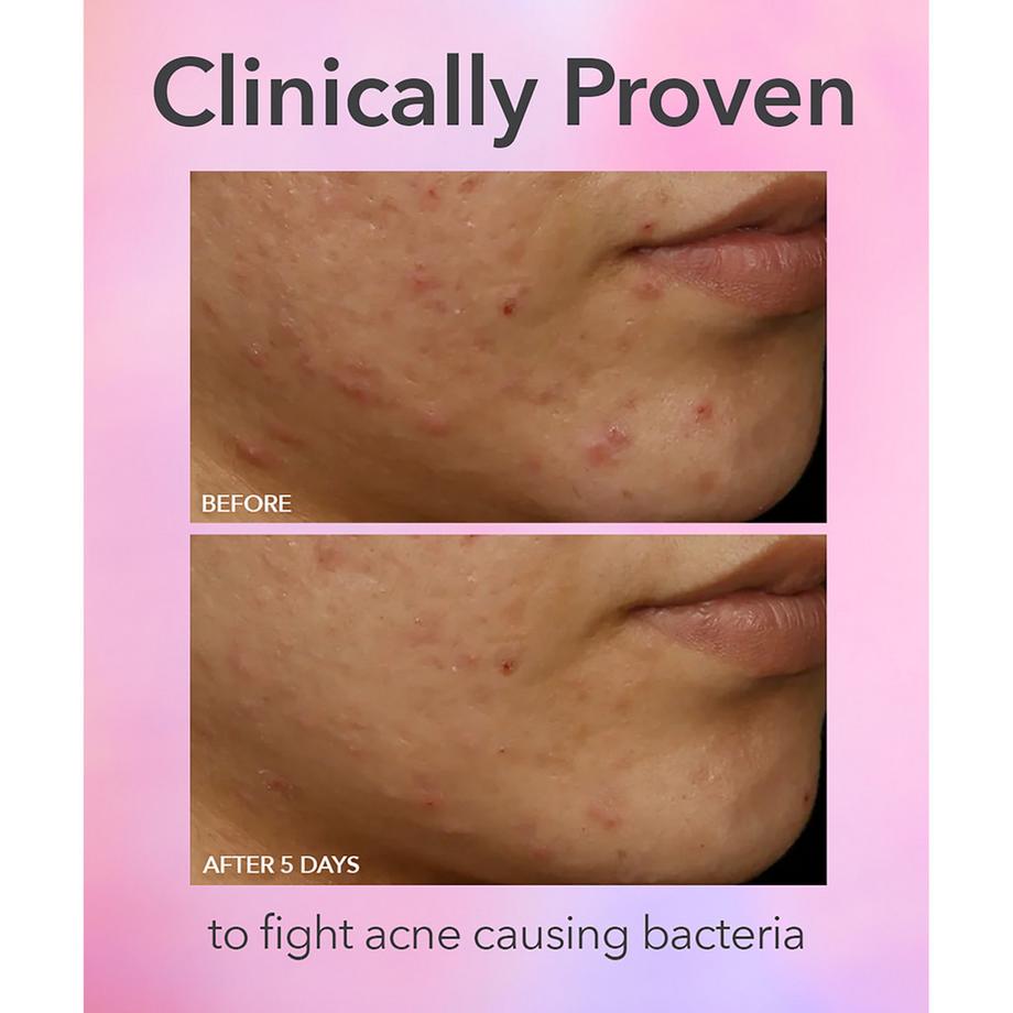 Dr Dennis Gross  DRx SpectraLite™ FaceWare Pro Original - LED-Gesichtsmaske 