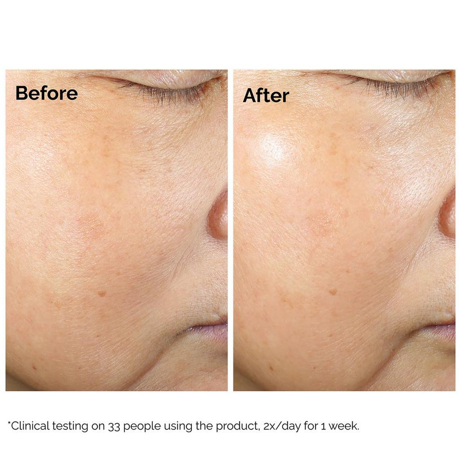 THE ORDINARY  Rice Lipid Microemulsion + Ectoine - Microemulsione idratante 