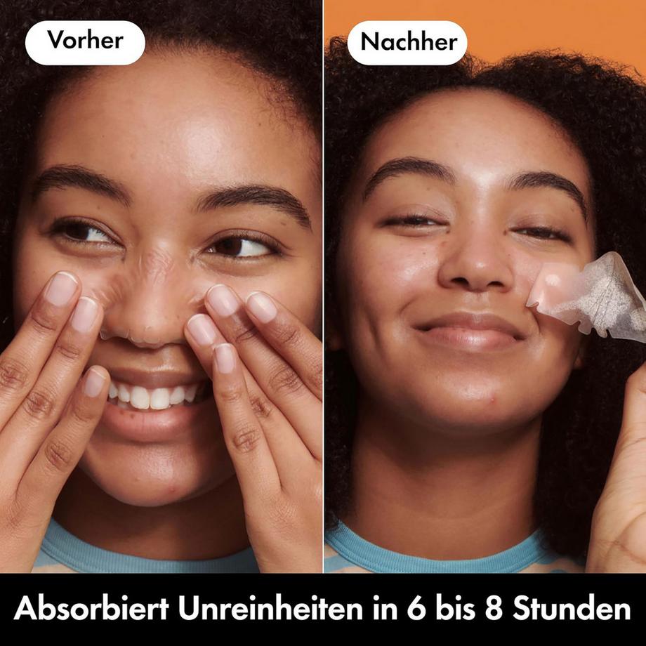 Hero.  Mighty Patch Nose 