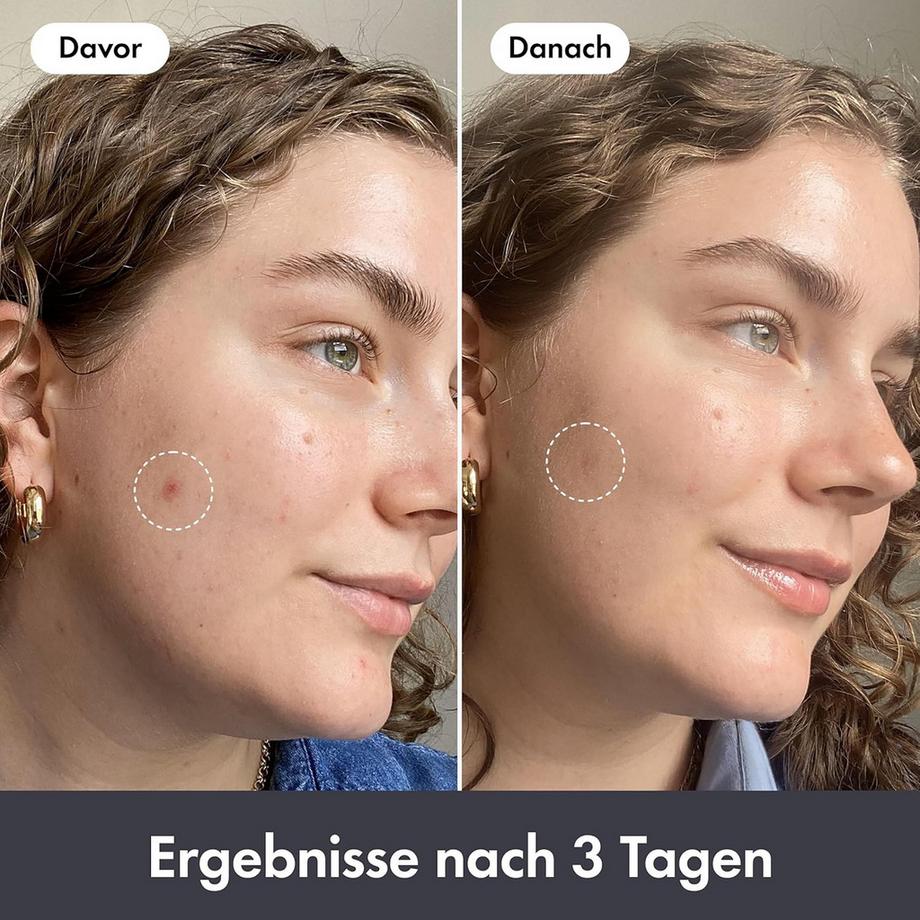 Hero.  Rescue Balm Original  