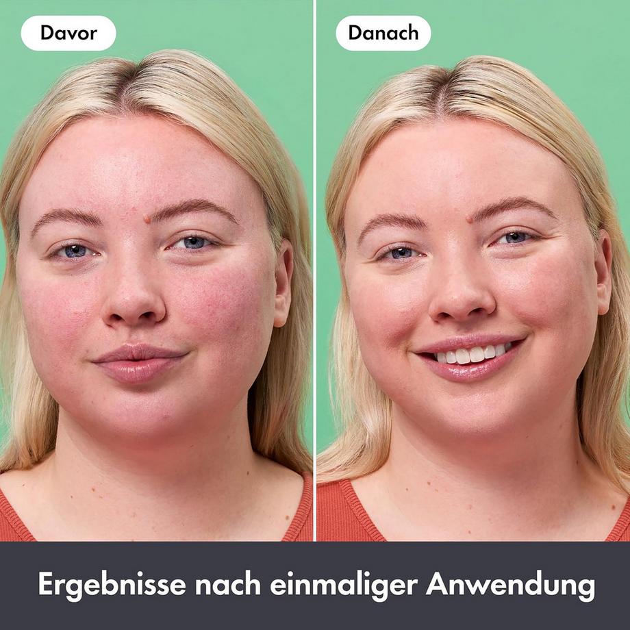 Hero.  Rescue Balm +red correct 