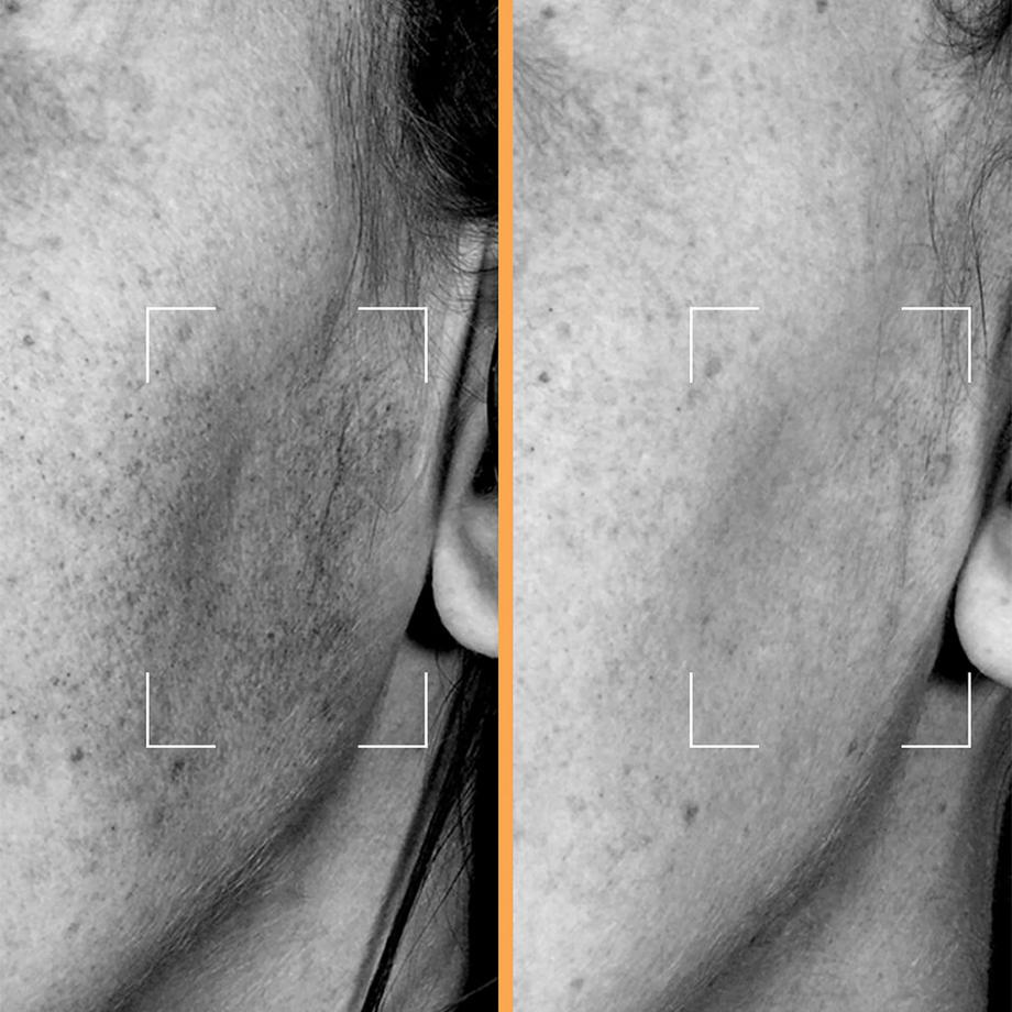 Lightinderm  Brightening Serum - Glow-Serum-Kapseln mit Niacinamid und Andrographis 