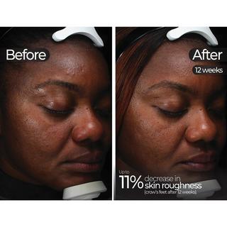 STYLPRO  LED-Maske 5-in-1 