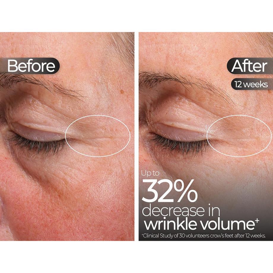 STYLPRO  Masque LED 5-en-1 