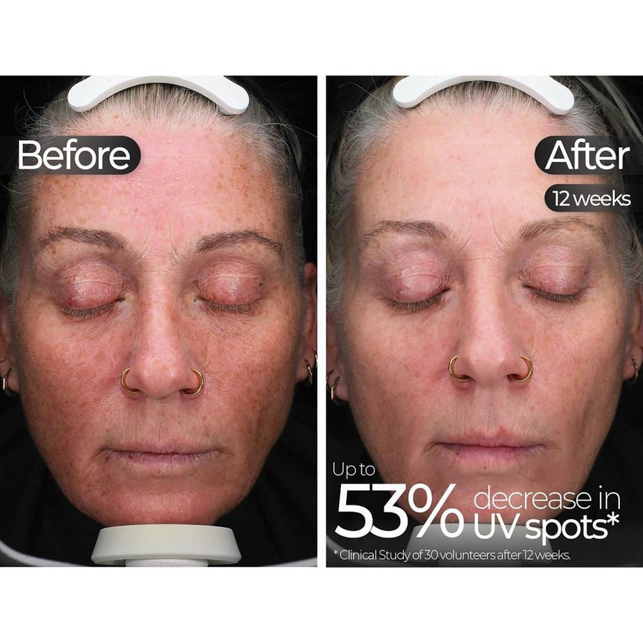 STYLPRO  Masque LED 5-en-1 