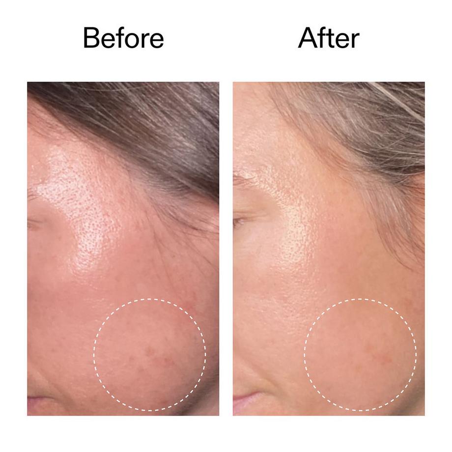 THE INKEY LIST  Advanced Retinal Serum - Fortschrittliches Retinal-Serum 