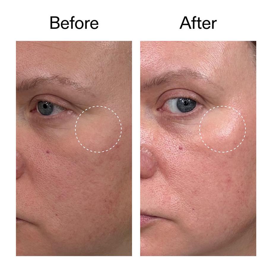 THE INKEY LIST  Advanced Retinal Serum - Fortschrittliches Retinal-Serum 