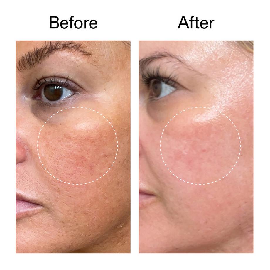 THE INKEY LIST  Starter Retinol Serum - Starter-Retinolserum 