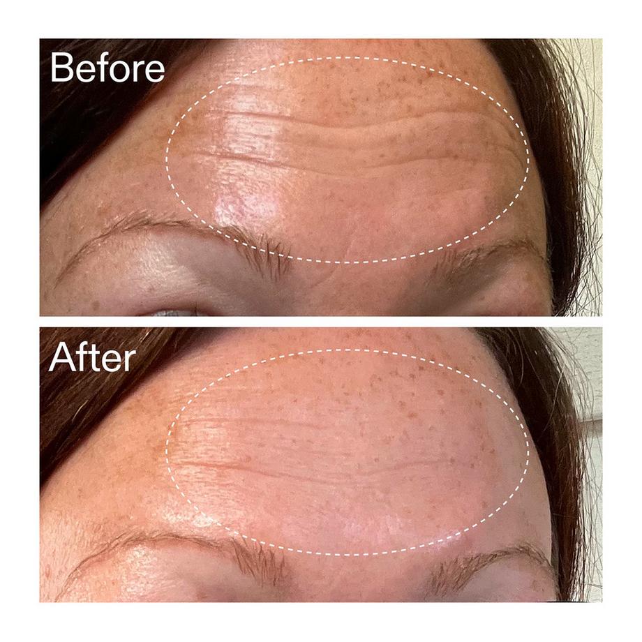 THE INKEY LIST  Starter Retinol Serum - Starter-Retinolserum 