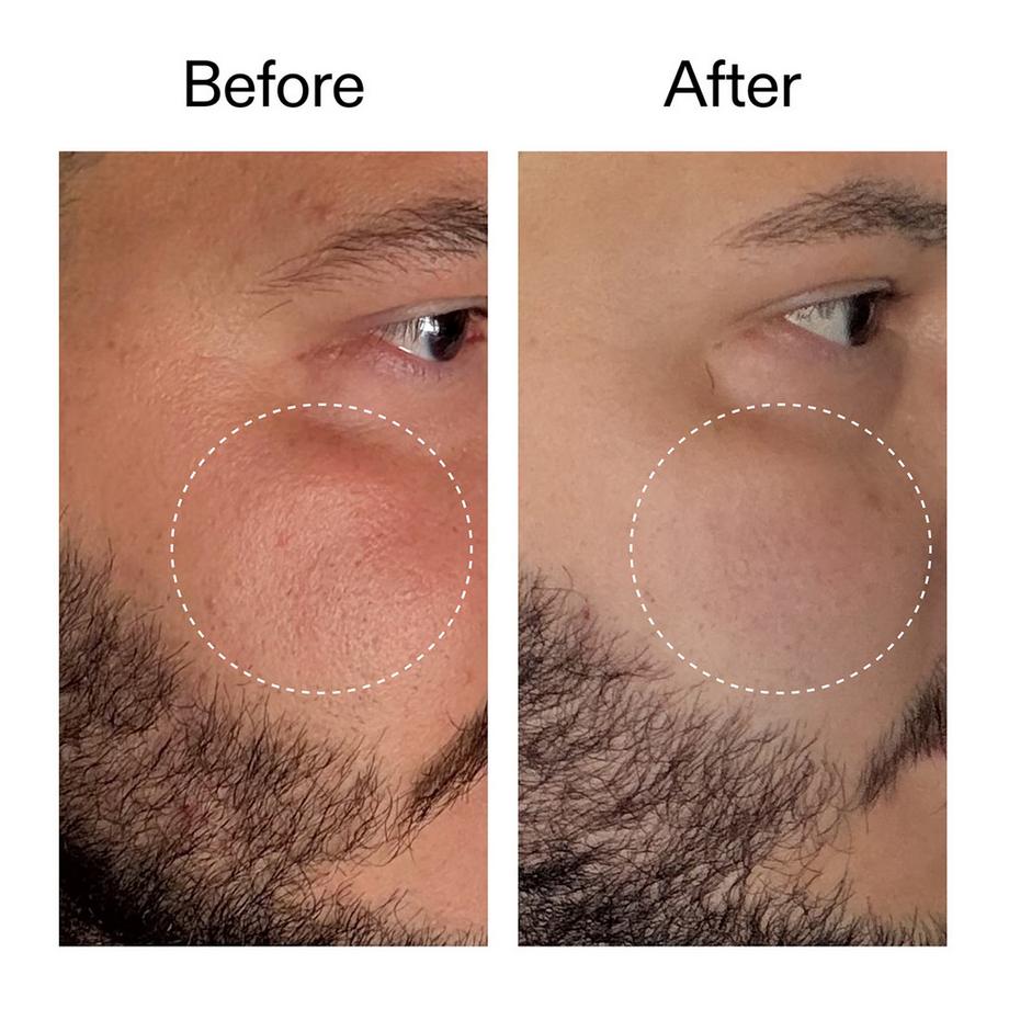 THE INKEY LIST  Starter Retinol Serum - Starter-Retinolserum 