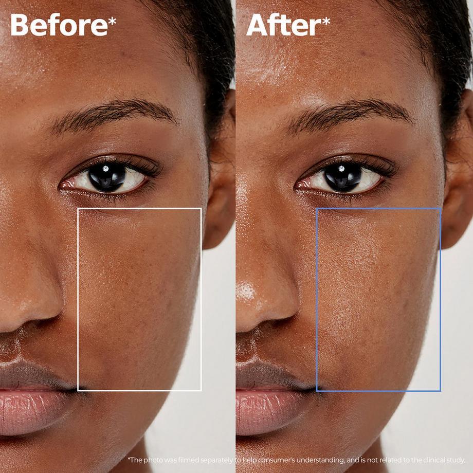 Aestura  ATOBARRIER365 Lotion - Feuchtigkeitsspendende Hautbarriere-Lotion 