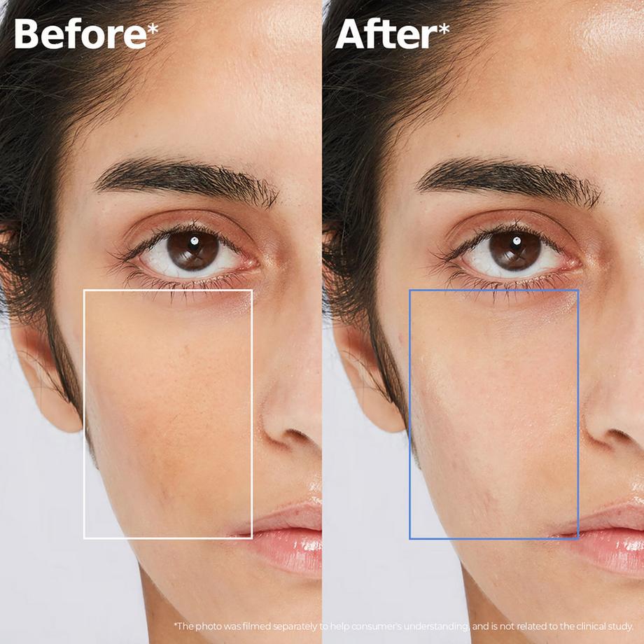 Aestura  ATOBARRIER365 Hydro-Essence - Feuchtigkeitsspendende Hautbarriere-Essenz 