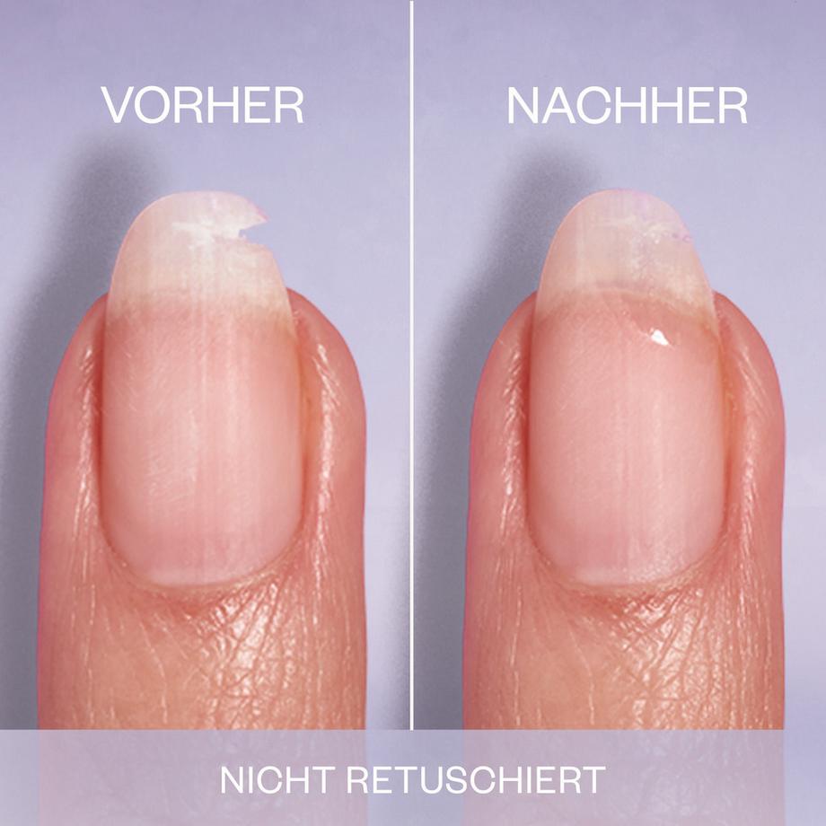 essie  Break Fix liquid nail patch Fixateur pour ongles cassés ou fissurés 