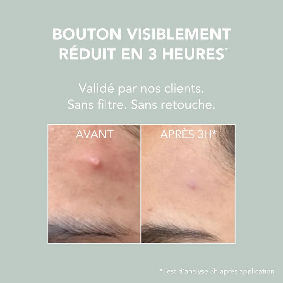 ON THE WILD SIDE  Pâte Stop-Bouton 