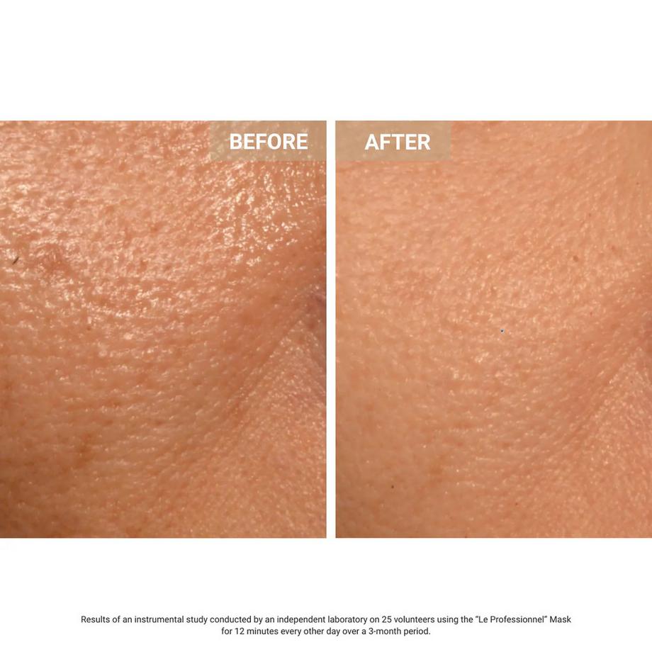 Nooance  Aurion X252 - Maschera LED anti-age 