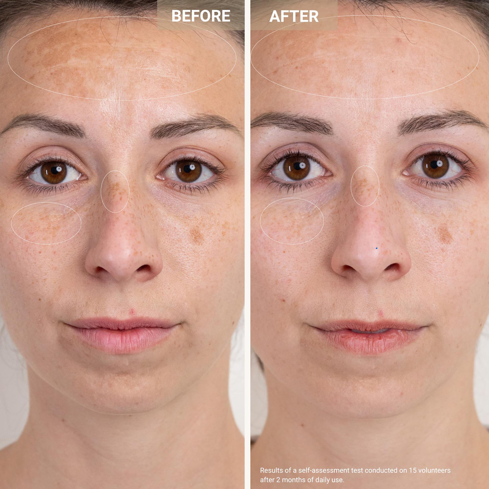 Nooance  Anti-Redness Clarifying Care - Sérum anti-rougeur & anti-imperfections 