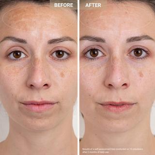 Nooance  Anti-Redness Clarifying Care - Sérum anti-rougeur & anti-imperfections 