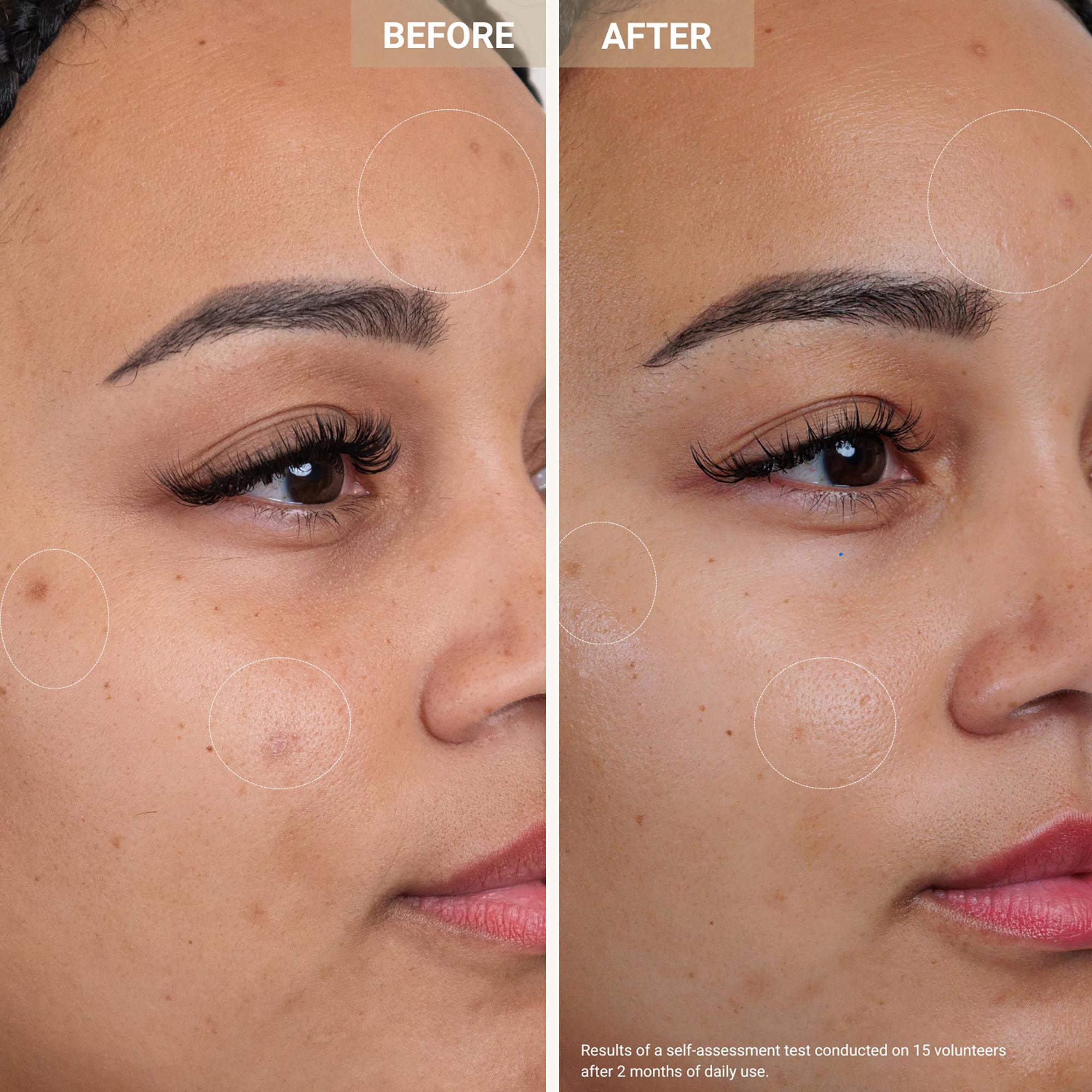 Nooance  Anti-Redness Clarifying Care - Sérum anti-rougeur & anti-imperfections 