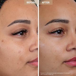 Nooance  Anti-Redness Clarifying Care - Sérum anti-rougeur & anti-imperfections 