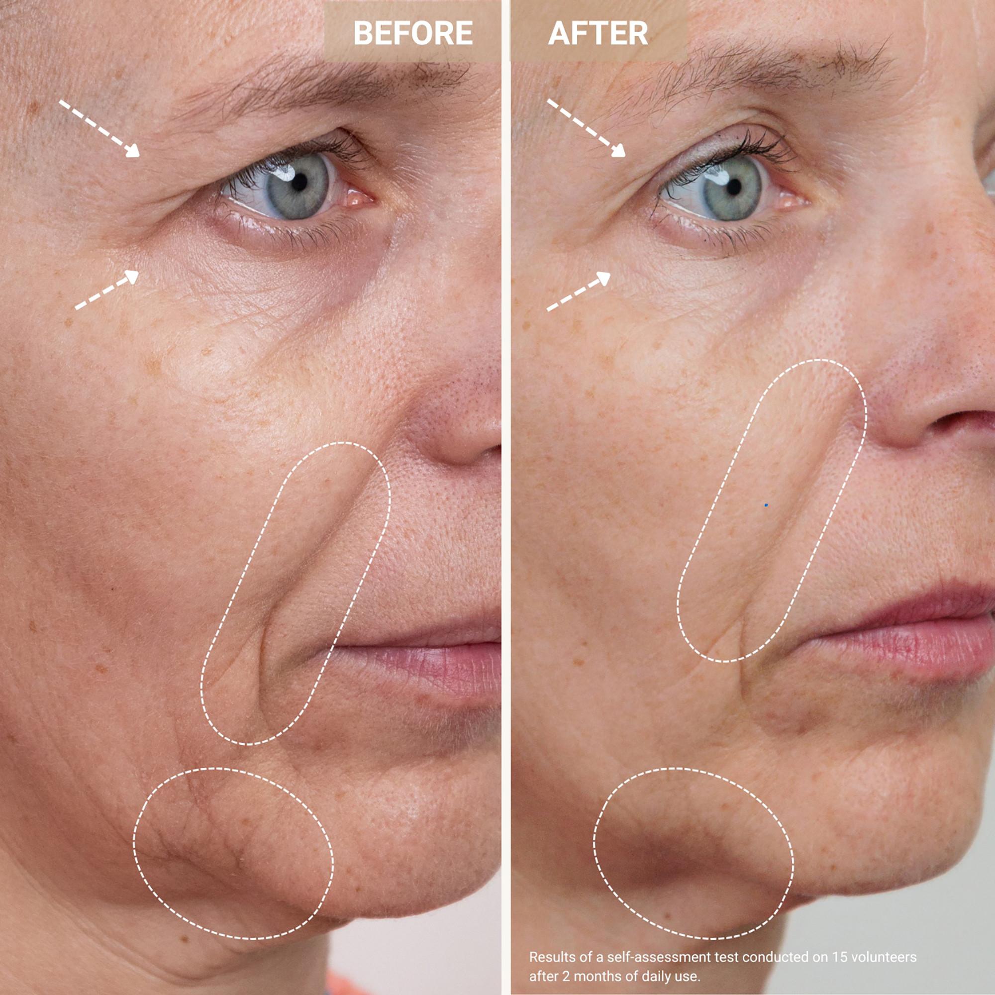 Nooance  Youth Serum - Sérum anti-âge aux peptides de cuivre 