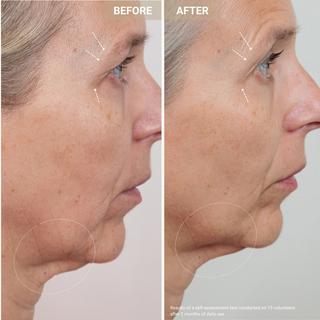 Nooance  Youth Serum - Sérum anti-âge aux peptides de cuivre 