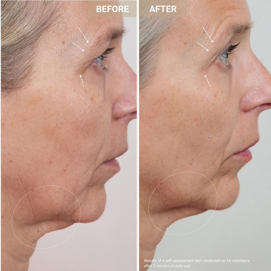 Nooance  Youth Serum - Anti-Aging-Serum mit Kupferpeptiden 